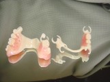 Dentures with duracital frame